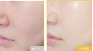 سيت- كولاجين اعمق واكثر كثافه للتبييض تحسين حاجز البشره و التجاعيد وتوهج الجلد| (SET ) Whitening and wrinkle White Jade Collagen 75